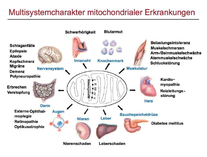 Schaubild Multisystemcharakter mitochondrialer Erkrankungen